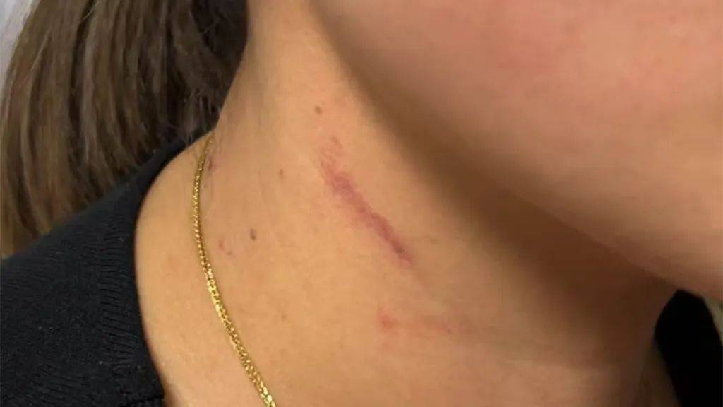 皇冠信用网会员_云南一男子酒后逼问妻子“是否出轨”并施暴皇冠信用网会员,被警方行拘4日