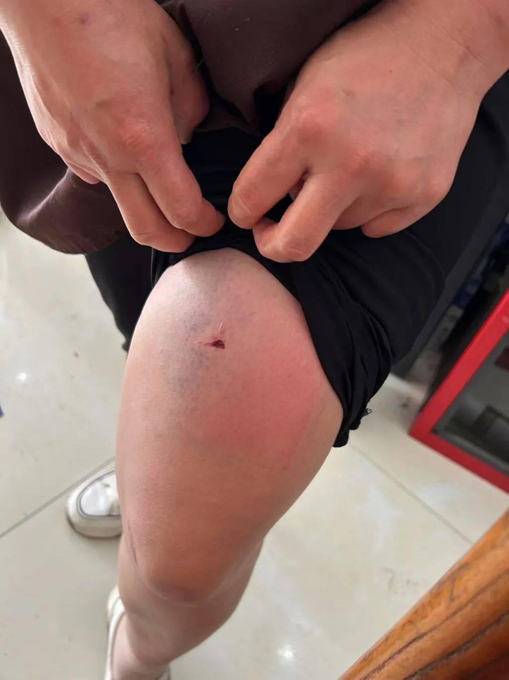 皇冠信用网会员_云南一男子酒后逼问妻子“是否出轨”并施暴皇冠信用网会员,被警方行拘4日