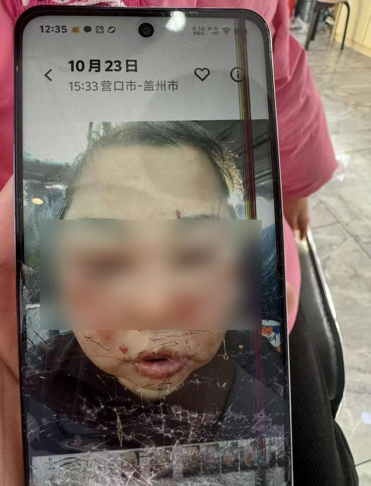 立陶宛vs德国_被前夫打进ICU的女子不幸身亡立陶宛vs德国,大女儿称正送母亲去殡仪馆,今后安排暂未考虑,希望严惩凶手